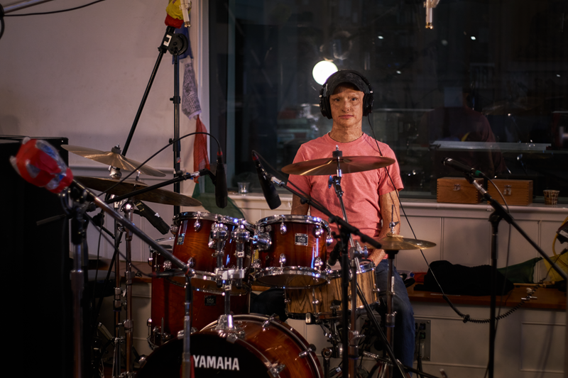 Young man with burn scars on face and wearing a ball cap sitting at a drumkit.